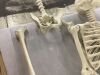 Plastic Skeleton - Needs Hip & Mouth Repaired - Thumbnail 4