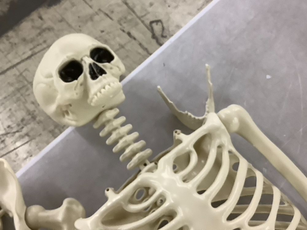 Plastic Skeleton - Needs Hip & Mouth Repaired - Image 5 - Lot 680